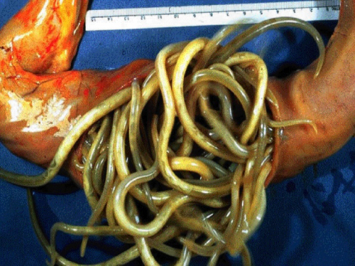 Roundworms (Parascaris equorum)